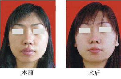 杭州哪家整形醫(yī)院口碑比較好，推薦浙江醫(yī)美排行榜前十佳