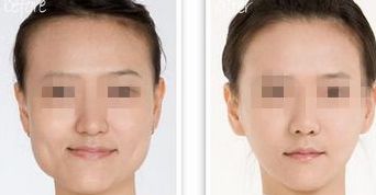 黑龍江三甲整形醫(yī)院熱門榜單，前三強(qiáng)大揭秘！