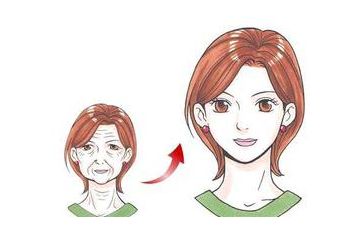 虞冬梅醫(yī)生雙眼皮修復效果分享:手術(shù)后真實圖賞析 虞冬梅醫(yī)生雙眼皮修復效果分享:手術(shù)后真實圖賞析