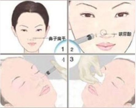 邯鄲維多利亞美容醫(yī)院體驗(yàn)全解析:門診介紹及價(jià)格指南 邯鄲維多利亞美容醫(yī)院體驗(yàn)全解析:門診介紹及價(jià)格指南