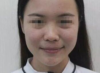 南充疤痕整形醫(yī)院排名精選，助你尋找完美去疤痕之旅