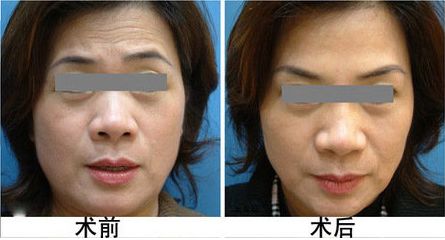 常州哪家唇部整形醫(yī)院值得信賴，價格如何？