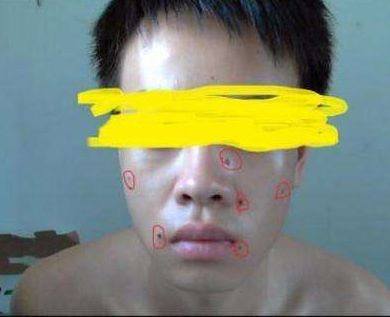 ?？谑笳吾t(yī)院匯總，哪家效果比較好？