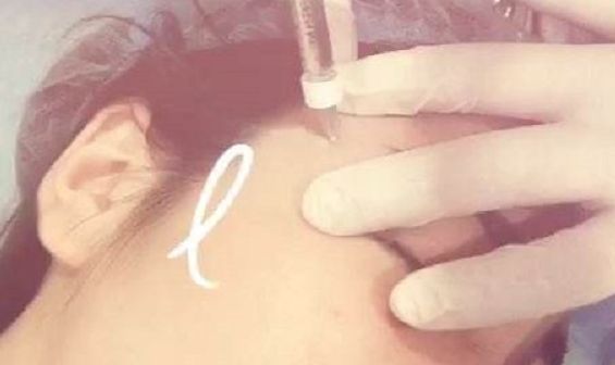 深圳前海地區(qū)哪家整形醫(yī)院比較靠譜？好的深圳整容醫(yī)院有哪些？