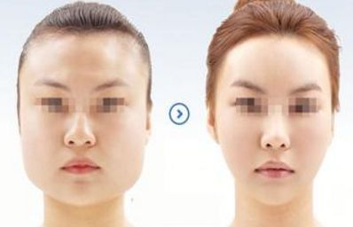 2024年溫州哪家醫(yī)院的整形美容效果最佳？