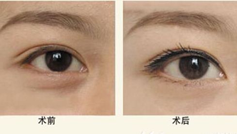 樂山人民醫(yī)院醫(yī)生特色項目與服務(wù)評價全解析 樂山人民醫(yī)院醫(yī)生特色項目與服務(wù)評價全解析