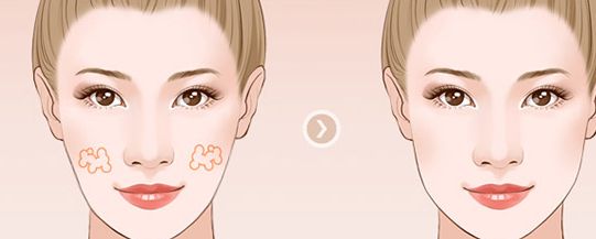 濟南整形醫(yī)院推薦:權(quán)威醫(yī)院排名及口碑比較 濟南整形醫(yī)院推薦:權(quán)威醫(yī)院排名及口碑比較