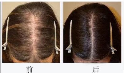 溫州粉范整形醫(yī)院坐診醫(yī)生團隊的技術(shù)和2023服務(wù)水準(zhǔn)綜合解析 溫州粉范整形醫(yī)院坐診醫(yī)生團隊的技術(shù)和2023服務(wù)水準(zhǔn)綜合解析
