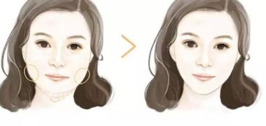 大連市哪些醫(yī)院是專業(yè)的開眼角整形中心？