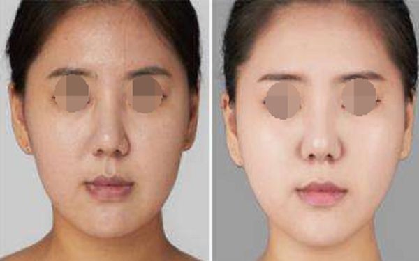 珠海博愛女子醫(yī)院整形外科項(xiàng)目全新推出，項(xiàng)目大揭秘