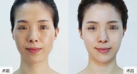 深圳美萊整形醫(yī)院位置介紹，牽手醫(yī)生，搶先體驗(yàn)熱門項(xiàng)目
