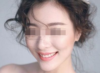 上海十大修復(fù)雙眼皮專家排行榜 上海十大修復(fù)雙眼皮專家排行榜