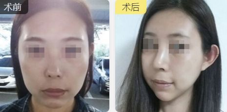 福州中聯(lián)美康醫(yī)療美容門診部的醫(yī)生技術及擅長項目推薦 福州中聯(lián)美康醫(yī)療美容門診部的醫(yī)生技術及擅長項目推薦