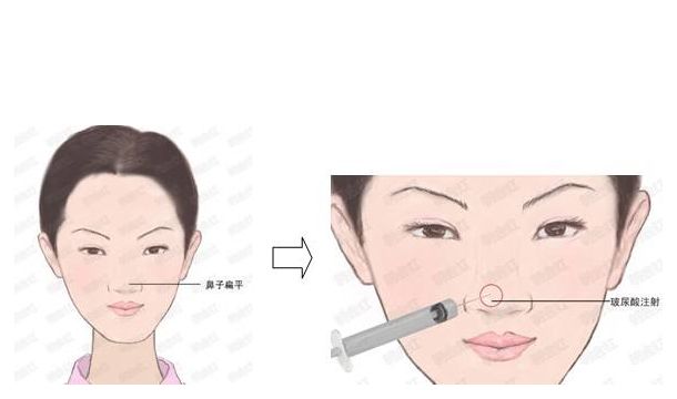 邯鄲萊媚儷整形：價格實惠，專業(yè)修復(fù)，雙眼皮、隆鼻等項目詳解！