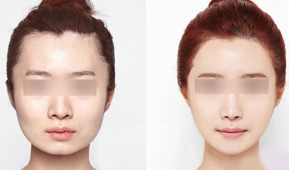 西安藝星醫(yī)療美容醫(yī)院2023年價格一覽：了解醫(yī)療美容服務(wù)費用信息，醫(yī)生簡介待查！