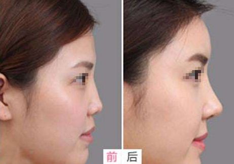 重慶小柯麗格口碑揭秘：權威機構認證，美麗蛻變首選