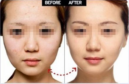 上海眼部整形醫(yī)院推薦，雙眼皮修復(fù)效果好