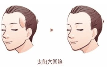 成都整形醫(yī)院排名前十名單整理，銅雀臺(tái)、米蘭柏羽何居首？