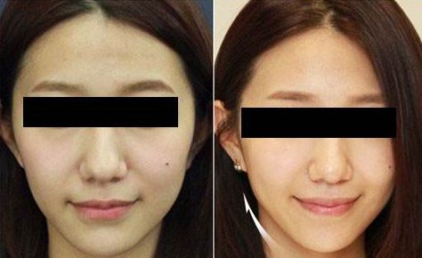 臨沂市哪家整形美容醫(yī)院口碑比較好？