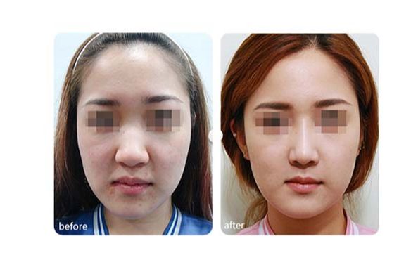 廣州優(yōu)質磨骨整形醫(yī)院推薦！TOP10醫(yī)療機構揭秘