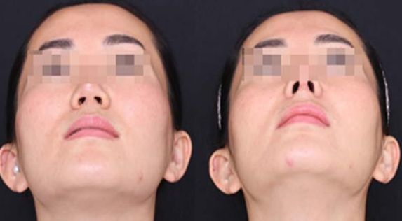 重慶哪家整形醫(yī)院口碑好？專業(yè)整形醫(yī)院推薦匯總