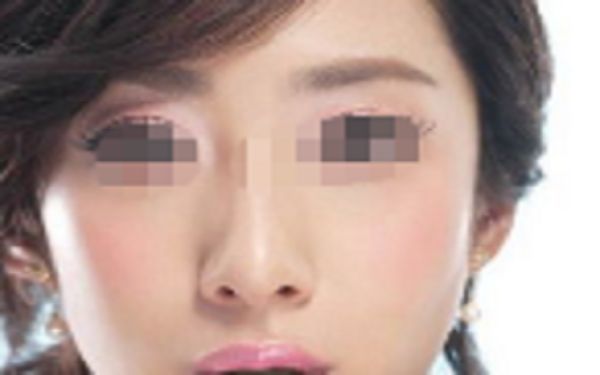 蘇州祛斑整形醫(yī)院哪家好？點(diǎn)擊查看排名前四家醫(yī)院名單！