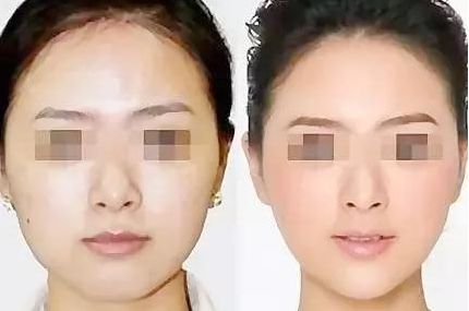 長(zhǎng)沙哪個(gè)醫(yī)院做雙眼皮最好？