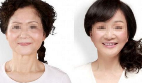 北京眼整形醫(yī)院排行榜：專業(yè)眼部整形推薦前六強！
