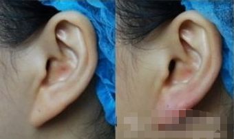 湖州哪家醫(yī)院能有效提升面部外觀？