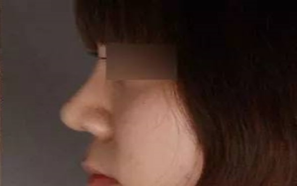 2023年匯總廣東地區(qū)三甲醫(yī)院雙眼皮手術排名TOP6 2023年匯總廣東地區(qū)三甲醫(yī)院雙眼皮手術排名TOP6