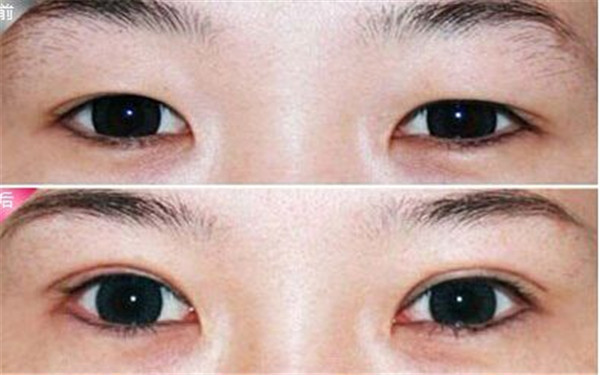 東莞最佳口腔診所盤點(diǎn)：這些醫(yī)院時(shí)刻守衛(wèi)您的口腔健康！