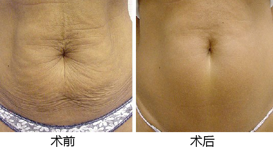 義烏整形醫(yī)院優(yōu)選TOP5，專業(yè)權(quán)威推薦，如何做出準(zhǔn)確選擇？深入了解為上策