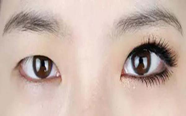 樂山整形醫(yī)院推薦：達(dá)芬奇與西嬋，你更喜歡哪一個？獲取比較結(jié)果！