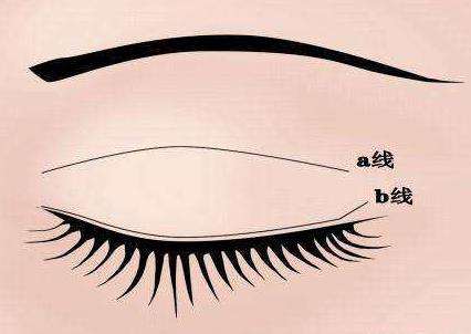 令人眼前一亮！遂寧多家雙眼皮整形醫(yī)院盤點(diǎn)，推薦陽光、伊莎貝拉等知名品牌，一起來了解吧