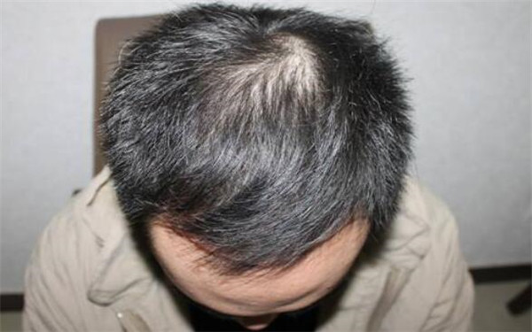 南昌三甲醫(yī)院全面盤點(diǎn)：專業(yè)美容整形醫(yī)院推薦，趕緊了解一下！