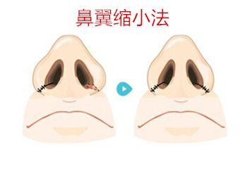 北京十大優(yōu)質(zhì)口腔醫(yī)院推薦，佳美第三醫(yī)院備受贊譽(yù)！中諾榜之精選參考