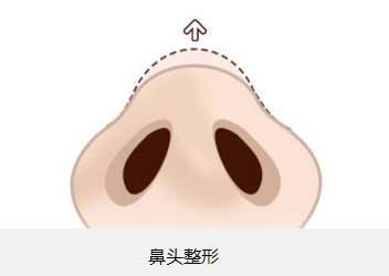 北京植眉醫(yī)院推薦：高新及新生，專業(yè)醫(yī)護(hù)技藝令人贊嘆！