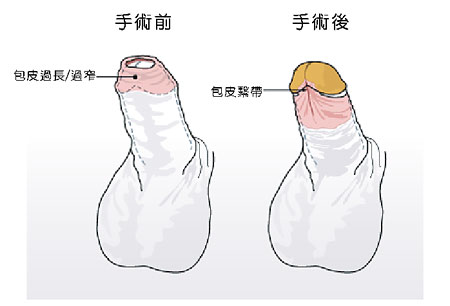 南京哪家醫(yī)院矯正牙齒比較好？推薦貝鶴雅康、美奧、貝芽、卡瓦、藍鱘等！