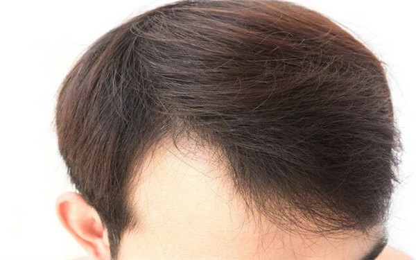 廣州整形醫(yī)院綜合指南：不可錯(cuò)過(guò)的醫(yī)美中心全解析！