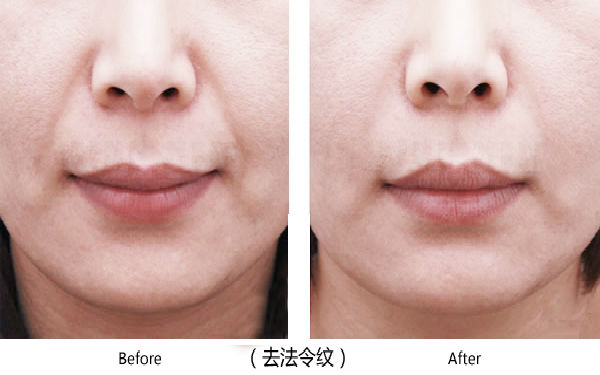 寶雞整容醫(yī)院大整頂級優(yōu)質(zhì)匯總！高一生對決愛容妍_絕對實(shí)力的對比震撼
