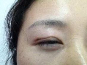 廣州隆鼻手術(shù)：挑選最好的醫(yī)生，口碑盤點(diǎn)！是否有你最滿意的專家？