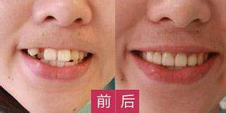哪家醫(yī)院適合進(jìn)行磨骨手術(shù)？江城和美立方廣受網(wǎng)友推崇！