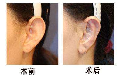 山東頂級整容名醫(yī)盤點(diǎn)，專家推薦詳細(xì)資料一覽！