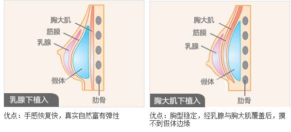 宜賓最佳雙眼皮整形醫(yī)院推薦！這七家美容院你絕不能錯(cuò)過