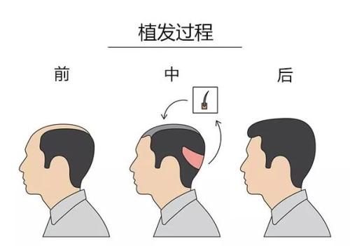 哈爾濱市排名靠前的整形醫(yī)院：公立與私立齊全，一定有一家適合您！