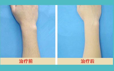 最新發(fā)布！匯總?cè)箩t(yī)院名單，解決牙齒問題待了整整一年
