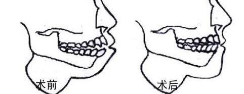 提供重慶哪家私立醫(yī)院割雙眼皮好？前五推薦_軍美領先，再揭秘