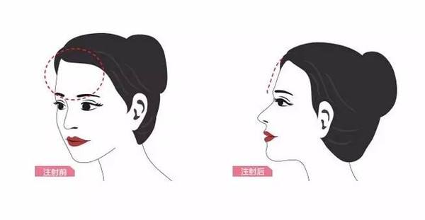 成都哪些醫(yī)院可進(jìn)行磨骨手術(shù)【三家鑒定】 成都哪些醫(yī)院可進(jìn)行磨骨手術(shù)【三家鑒定】