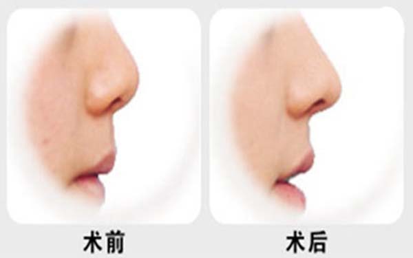 杭州專業(yè)整形美容醫(yī)院推薦榜單TOP7！熱門前三家療效不凡~