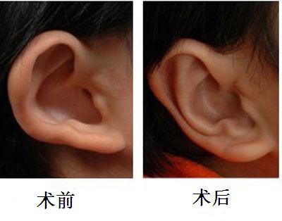 杭州口腔疾病治療首選！濃縮優(yōu)質(zhì)、平價口腔醫(yī)院一站攻略